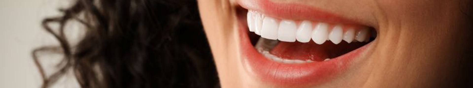 Close-up of woman’s smile with perfect teeth