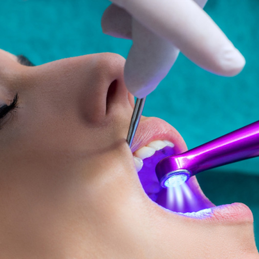 Teen getting a dental sealant