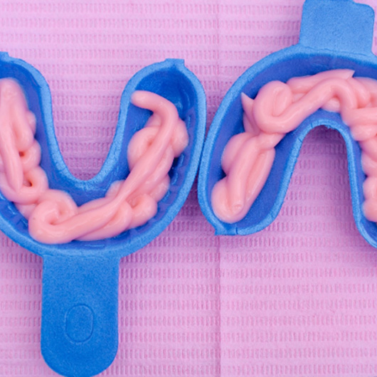 Fluoride treatment in mouth inserts