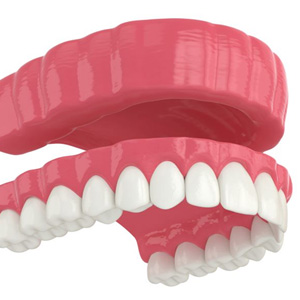 Illustration of full denture for upper arch