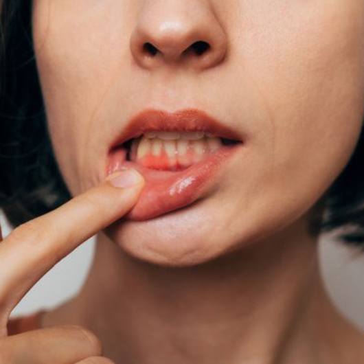 Lady shows inflamed gum tissue