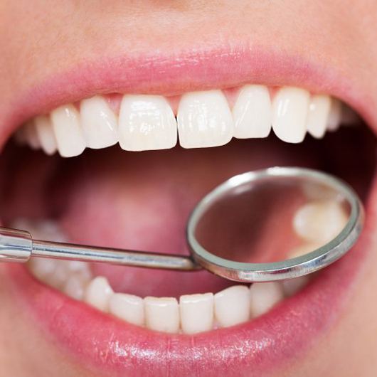 Teeth examined with dental mirror