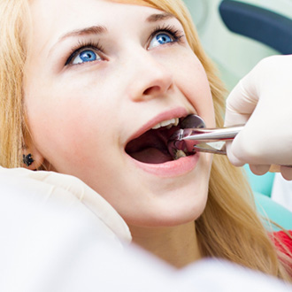 Extracting a tooth can be more affordable initially, but may end up costing more later